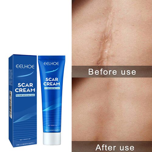 EELHOE Skin Care Cream - Gentle External Body Care for Moist