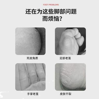 Pedicure Kit 23 in 1 Stainless Steel Professional Pedicure T