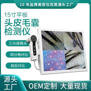 15寸四分格头皮检测仪高清一体机智能毛囊毛发分析仪皮肤检测仪