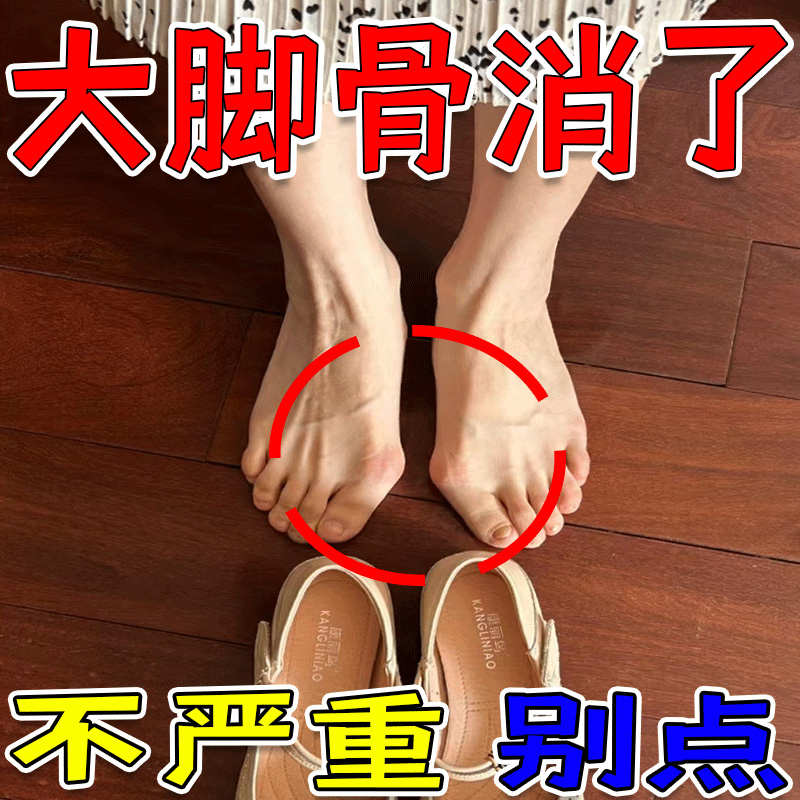 拇指外翻贴矫正神器冶大脚骨疼痛重叠关节畸形防磨脚趾外翻专用