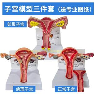 人体模型女性生殖子宫模型生殖卵巢模型教学模具病理变化科学教具