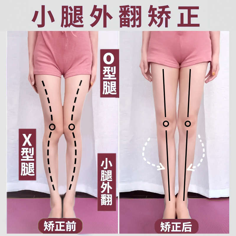 o型腿矫正器神器纠正xo型x型小腿内扣鞋垫膝盖外翻直腿成人罗圈腿