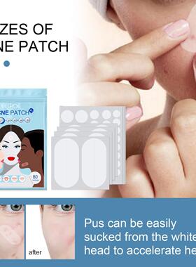 EELHOE Acne Patches - Hydrocolloid Invisible Pimple Patches