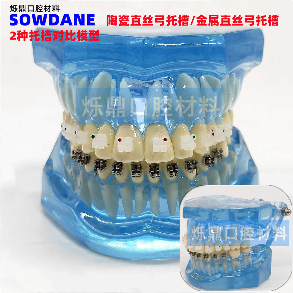 牙科正畸矫正模型金属自锁陶瓷托槽金属托槽对比模型教学医患沟通