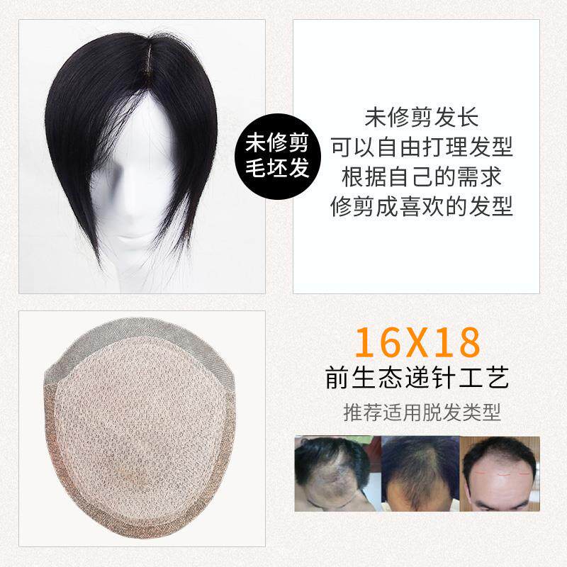 高档士男发头顶补发男短假递针真发补发块前额发际线 线隐无痕形