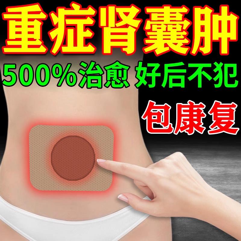 肾囊肿特效治疗腰腹疼痛肿块尿血尿蛋白积水专肾用的中穴位贴相冠