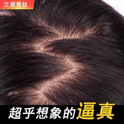 正品递发针真发片隐盖形无痕遮白发顶补发块头顶补发片女真发假发