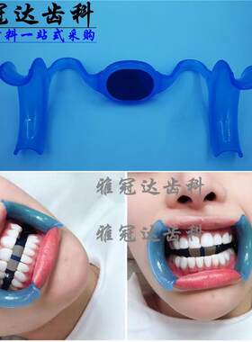 牙科口腔扩口器贴面美牙扩嘴器撑口撑嘴器撑牙器扩张器牙撑