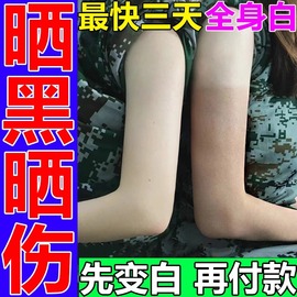 晒黑了皮肤晒伤晒后军训修复黑怎么快速变白霜儿童男士美白乳面霜