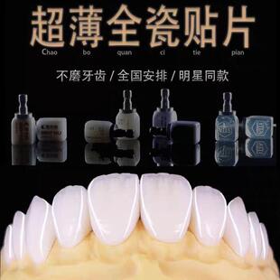 全瓷贴面超薄义获嘉灵犀瓷蓝瓷牙缝黄牙遮色美白瓷贴面牙齿贴片