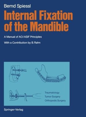 【预订】Internal Fixation of the Mandible: A...