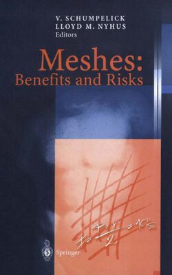 【预订】Meshes: Benefits and Risks