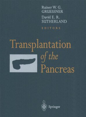 【预订】Transplantation of the Pancreas