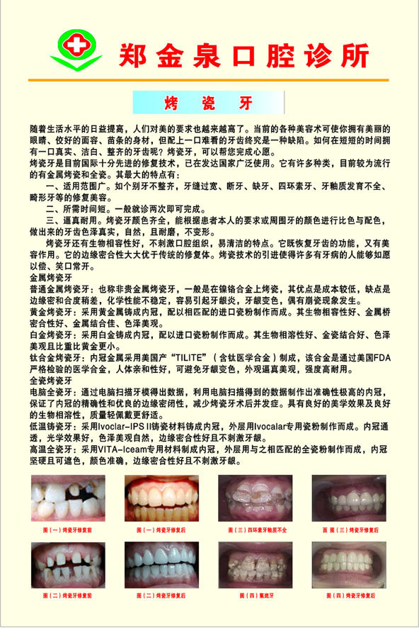 599海报印制海报展板素材356口腔诊所烤瓷牙