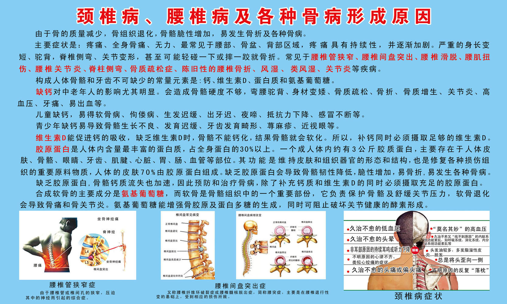 555海报印制展板1114颈椎病 腰椎病及各种骨病形成原因 个性定制