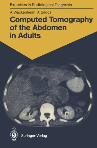 【预订】Computed Tomography of the Abdomen i...