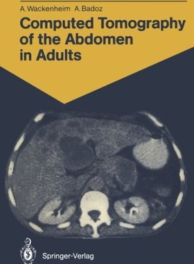 【预订】Computed Tomography of the Abdomen i...