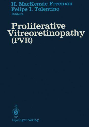【预订】Proliferative Vitreoretinopathy (Pvr...