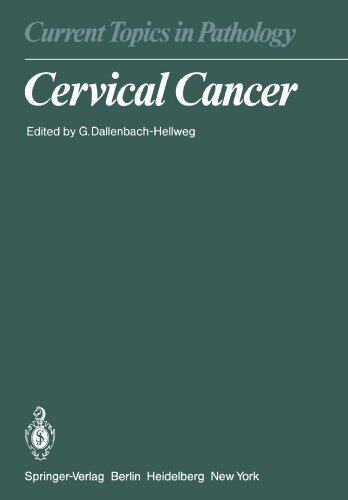 【预订】Cervical Cancer