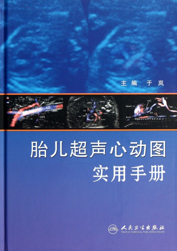 胎儿超声心动图实用手册(精) 医学卫生 正版书籍 木垛图书