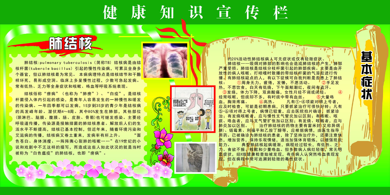 655海报印制定制展板素材110健康知识宣传栏肺结核基本症状