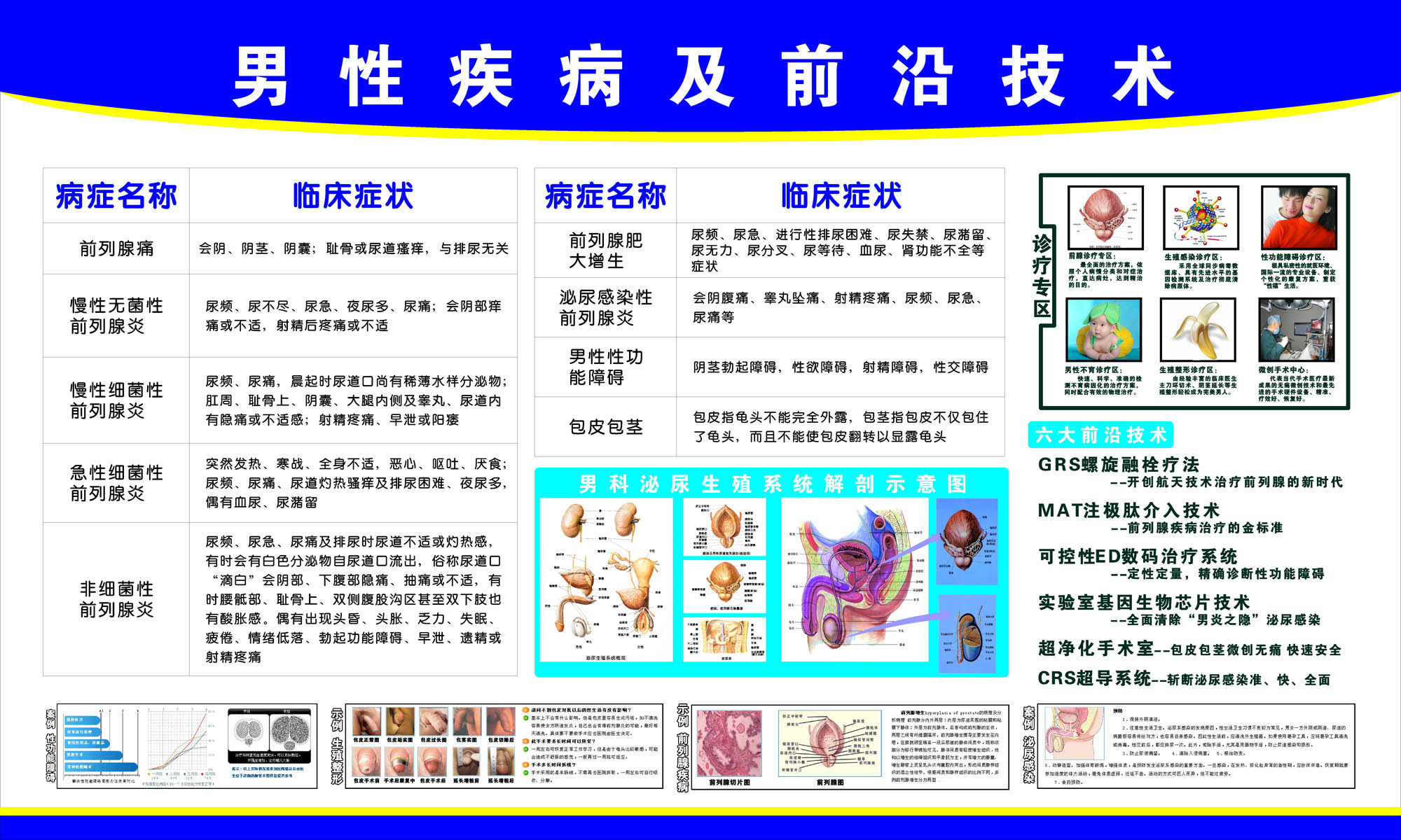 海报印制109素材常用挂图海报展板383男科疾病挂图