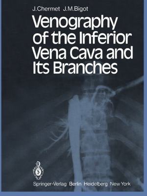 【预订】Venography of the Inferior Vena Cava...