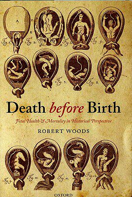 【预售】Death Before Birth: Fetal Health and Mortality