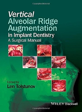 【预订】Vertical Alveolar Ridge Augmentation...