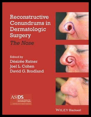 【预售】Reconstructive Conundrums in Dermatologic Surgery