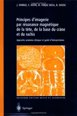 【预售】Principes D'Imagerie Par Resonance Magnetique ...