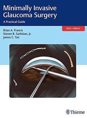 【预订】Minimally Invasive Glaucoma Surgery