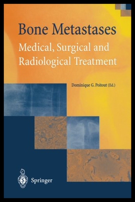 【预售】Bone Metastases: Medical, Surgical and Radiologic