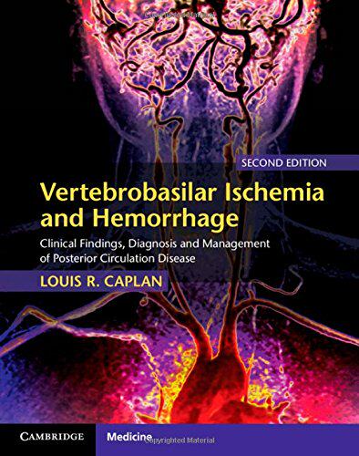 【预订】Vertebrobasilar Ischemia and Hemorrhage