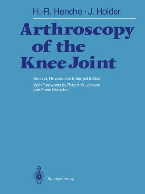 【预订】Arthroscopy of the Knee Joint: Diagn...