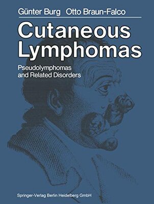 【预订】Cutaneous Lymphomas, Pseudolymphomas...
