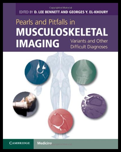 美国库房发货，通常付款后5-8周到货！