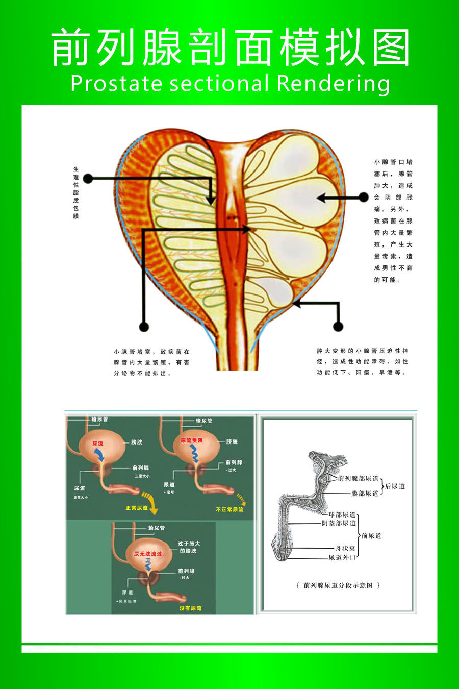 748海报印制展板写真喷绘219医院健康知识宣传之前列腺剖面模拟图