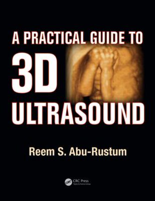 【预售】A Practical Guide to 3D Ultrasound