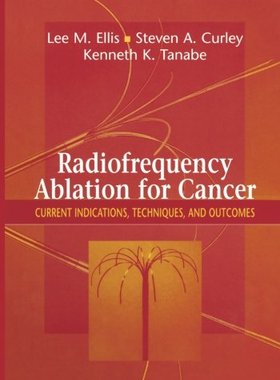 【预订】Radiofrequency Ablation for Cancer: ...