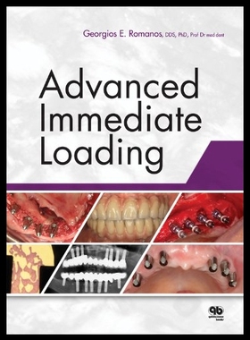 【预售】Advanced Immediate Loading