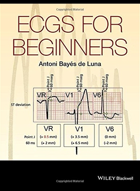 【预售】Ecgs for Beginners