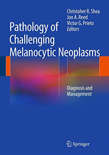 【预售】Pathology of Challenging Melanocytic Neoplasms...