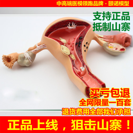颐诺正品人体子宫卵巢阴道疾病模型生殖科妇科医用医患模型