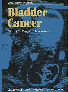 【预售】Bladder Cancer