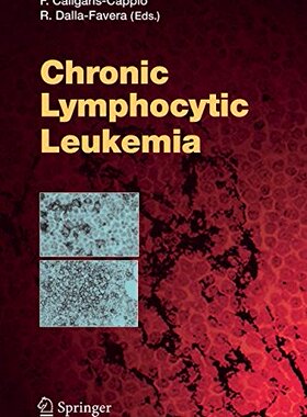 【预订】Chronic Lymphocytic Leukemia