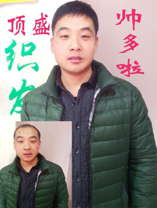 Extension cheveux - Ref 220397 Image 1