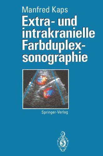 【预订】extra- und intrakranielle farbduplex.