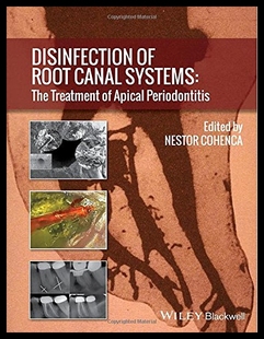 Root Canal The Disinfection Systems Treatment 预售