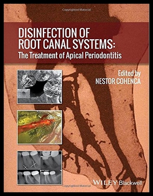 【预售】Disinfection of Root Canal Systems: The Treatment